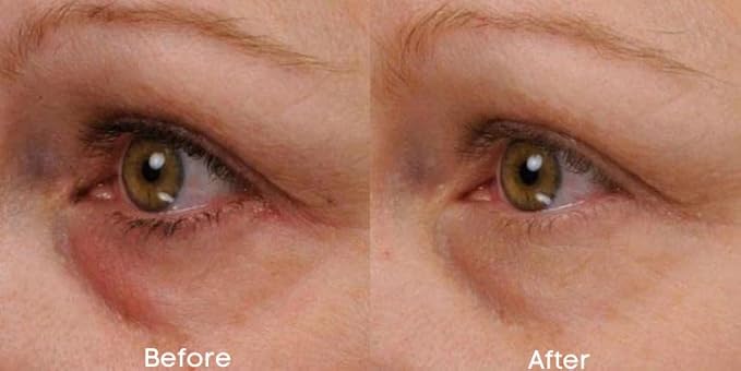Renew & Firm Eye Serum-BrightBean Baby