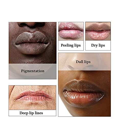 2pcs Lip Lightening for Dark Lips Lip Brightener for Smokers Dark Lip Treatment Lightening Cream for Pink Lips Lip Lightener for Smoker Lips Lip Lightening balm for Men and Women (Yellow)-BrightBean Baby