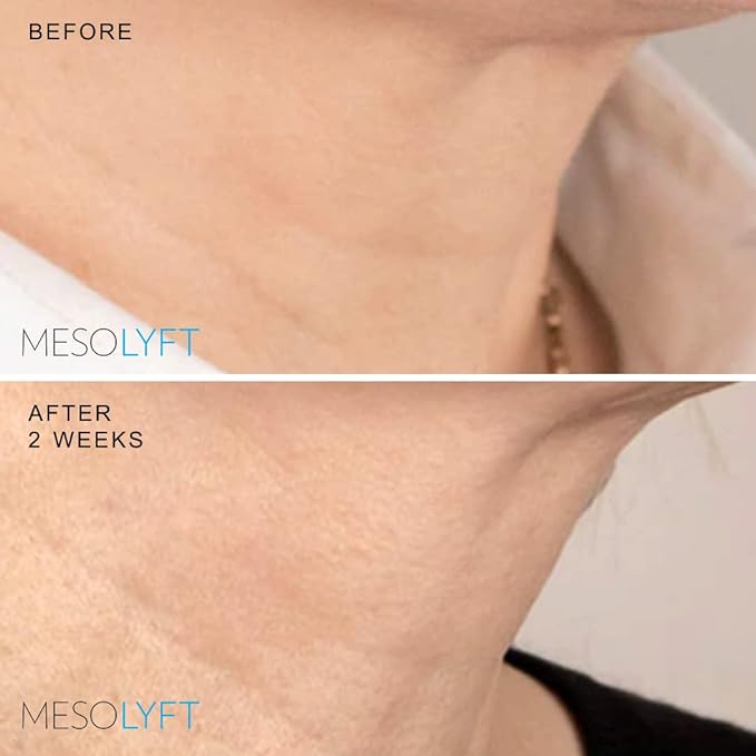 Neck & Eyes Combo Skincare Tool under Eye Serum With Neck Line Remover Neck and Décolletage Beuty Tool & Under Eye Wrinkle Filler Exfoliates the Skin, Visibly Firm & Smooth Necklines-BrightBean Baby
