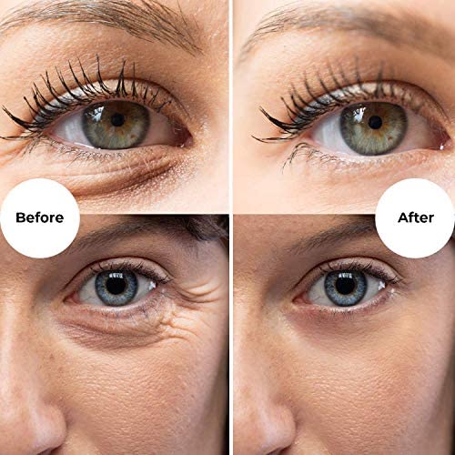 Gle Vitamin C Eye Serum for Dark Circles, Eye Wrinkles and Redness | Dark Circle Under Eye Puffy Eyes Treatment | Caffeine, Vitamin C Hyaluronic Acid | Hydrating & Brightening Scent-Free Travel Size-BrightBean Baby