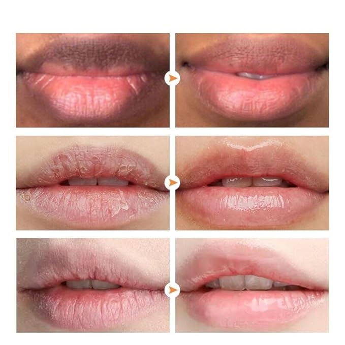 2pcs Lip Lightening for Dark Lips Lip Brightener for Smokers Dark Lip Treatment Lightening Cream for Pink Lips Lip Lightener for Smoker Lips Lip Lightening balm for Men and Women (Yellow)-BrightBean Baby