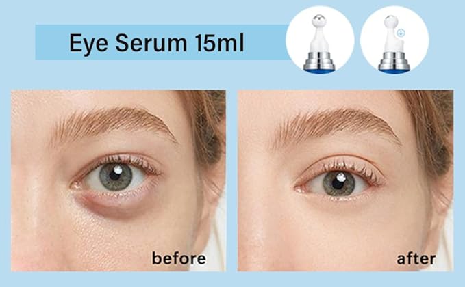 5% Caffeine Eye Serum, Under Eye Roller Cream for Dark Circles and Puffiness with 360°Massage Ball Reduce Wrinkles and Fine Lines,Bags Under Eyes,15ML-BrightBean Baby