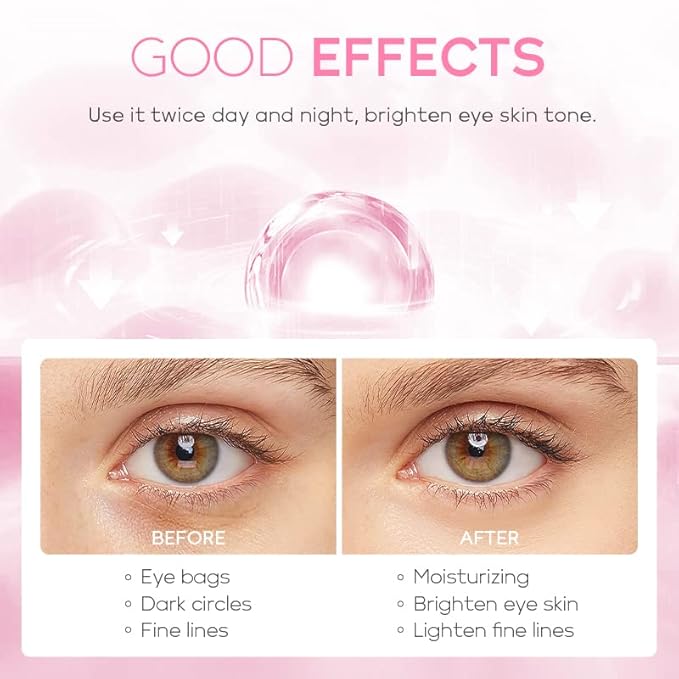 AKARY Cherry Blossom Eye Cream with Hyaluronic Acid, Lightweight Skincare Eye Cream for Dark Circles and Puffiness, Hydrating Under Eye Cream for All Skin Types, Cruelty-Free & Fragrance-Free-BrightBean Baby
