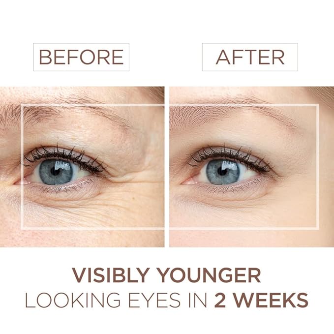 BEE and YOU Eye Cream, Anti Aging, Anti Wrinkle Serum 100% Natural with Bee Venom, Propolis Extract, Raw Honey, Hyaluronic Acid, For Dark Circles Under Eye Treatment and Puffiness, Skin Care, 15ml-BrightBean Baby