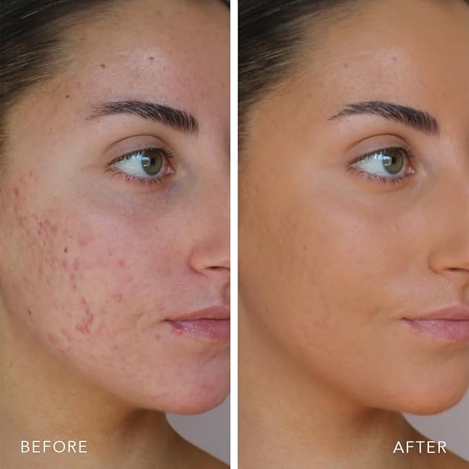 Doll 10 TCE Liquid Filter - Covers, Blurs, and Brightens (Deep/Rich)-BrightBean Baby