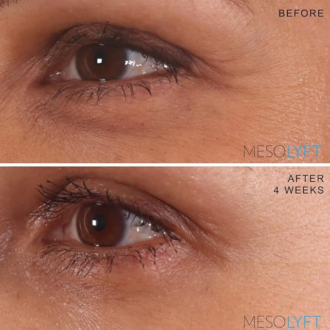 Neck & Eyes Combo Skincare Tool under Eye Serum With Neck Line Remover Neck and Décolletage Beuty Tool & Under Eye Wrinkle Filler Exfoliates the Skin, Visibly Firm & Smooth Necklines-BrightBean Baby