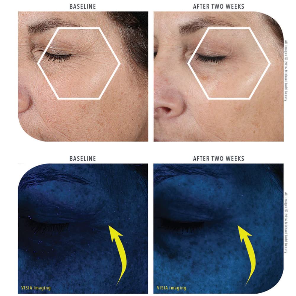 MICHAEL TODD Beauty KNU Cream – Face Lifting, Brightening & Tightening Cream – For Moisturizing & Rejuvenating – With Bakuchiol, Peptides & Snail Secretion – For All Skin Types – 1.68 fl oz/50 mL-BrightBean Baby