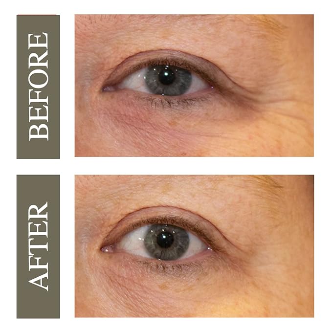 Hey Honey Open Your Eyes Lifting Eye Serum | Under Eye Cream for Dark Circles & Puffiness | Around The Eyes Hydration | Suitable For Sensitive Aging Skin | Delivers A Bright Rested look | 0.5 oz.-BrightBean Baby
