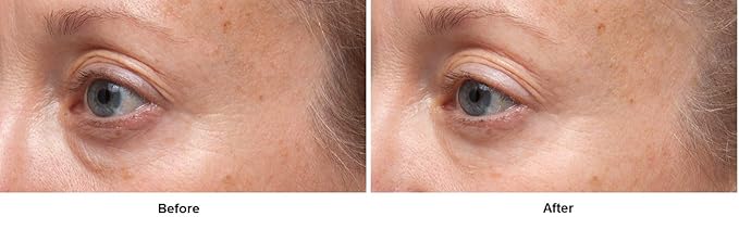 Dr. Dennis Gross Ferulic + Retinol Triple Correction Eye Serum: for Wrinkles, Loss of Elasticity, and Rough Texture, 0.5 fl oz-BrightBean Baby