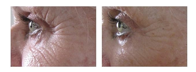 Airelle Age-Defying Eye and Lip Treatment | Anti Aging, Helps Reduce Wrinkles, Fine Lines | Dermatologist Recommended | Hyaluronic Acid, Berrimatrix | Natural Ingredients | .3 Fl Oz-BrightBean Baby