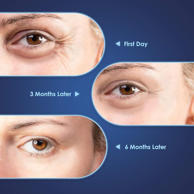 Brightening Vitamin C Eye Gel Cream for Dark Circles & Puffiness, Eye Cream to Help Reduce Fine Lines & Crow's Feet, Boost Hydrating Under Eye Treatment with Hyaluronic Acid & Peptides-BrightBean Baby