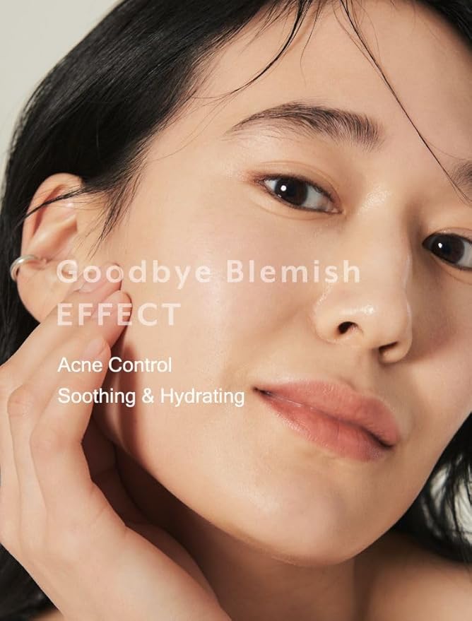 MIZON Goodbye Blemish Fresh Toner, BHA, Niacinamide for Excessive Sebum, Troubled Skin, Acne Treatment, Breakout Treatment, Korean Skincare, Acne Spot Treatment, Smooth Skin (120ml/4.05 fl. oz.)-BrightBean Baby