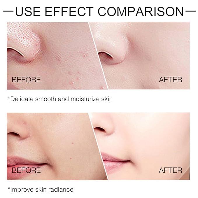 O’KADY 9 Pcs skincare set Anti Aging Skin Daily Care Routine Kit With Vitamin C and Peptides Facial Cleanser Eye Mask Toner Serum Eye Cream Lotion Cream Lady Cream Gifts sets for Valentine's Day-BrightBean Baby