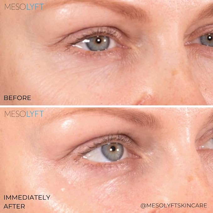 Neck & Eyes Combo Skincare Tool under Eye Serum With Neck Line Remover Neck and Décolletage Beuty Tool & Under Eye Wrinkle Filler Exfoliates the Skin, Visibly Firm & Smooth Necklines-BrightBean Baby