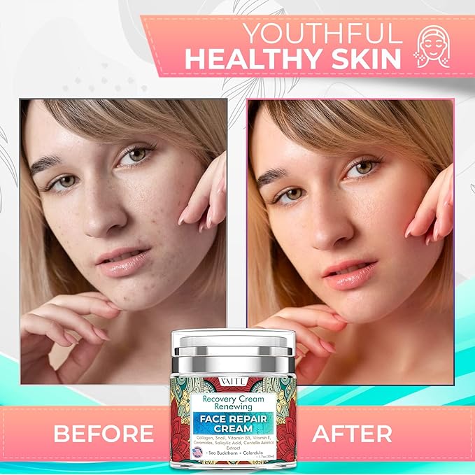 VAITE Face Moisturizer Remedy Skin Repair Cream with Snail, Salicylic Acid, Vitamin B5, Vitamin E, Collagen, and Ceramides for Men and Women Anti-aging Anti-wrinkle Made in USA Night and Day-BrightBean Baby