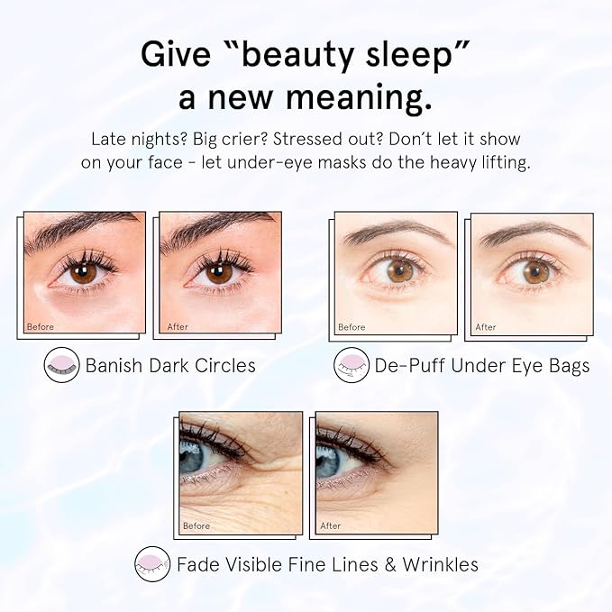 grace & stella Retinol Under Eye Patches for Puffy Eyes and Dark Circles - Restoring Gel Under Eye Masks with Hyaluronic Acid - Vegan Cruelty-Free Skincare, Birthday Gifts for Women (Purple, 24 Pairs)-BrightBean Baby