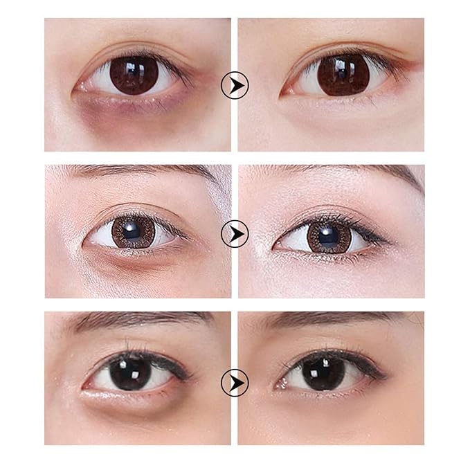 30 Pairs Hyaluronic Acid Collagen Eye Mask,Moisturizing Brightening Eye Mask, Eyes Treatment for Reducing Dark Circles, Lighten Wrinkles Anti-Aging, Fine Lines Eye Bags Puffiness for Women Men-BrightBean Baby