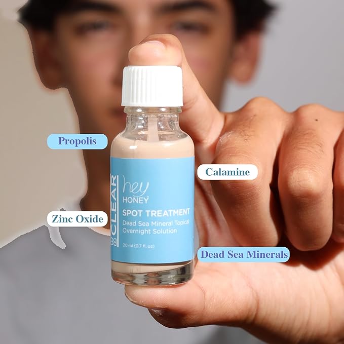 Hey Honey Skincare Be Clear - Acne Spot Treatment Overnight, Pimple Drying Lotion, Use Over Zits Whitehead & Blemishes 1 OZ-BrightBean Baby