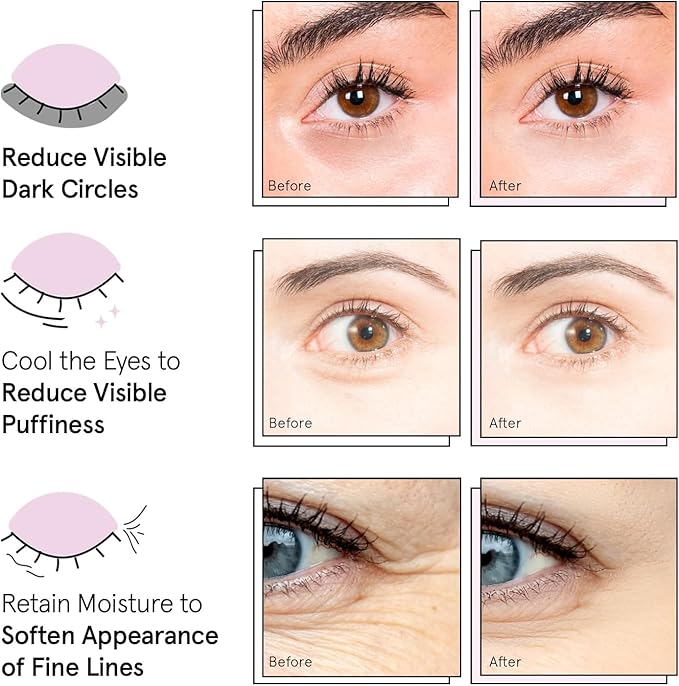 grace & stella Award Winning Under Eye Mask - Reduce Dark Circles, Puffy Eyes, Undereye Bags, Wrinkles - Gel Under Eye Patches - Gifts for Mom - Vegan Cruelty-Free Self Care (Pink, 6 Pairs)-BrightBean Baby