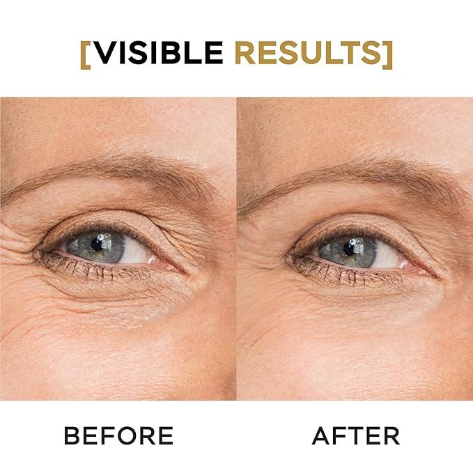 Moisturizing Eye Cream w/Aloe Vera, Collagen, Hyaluronic Acid, Cotton Stem Cells for Dark Circles, Puffiness & Bags - Under Eye Hydration Cream for Women & Men (1 Fl Oz)-BrightBean Baby