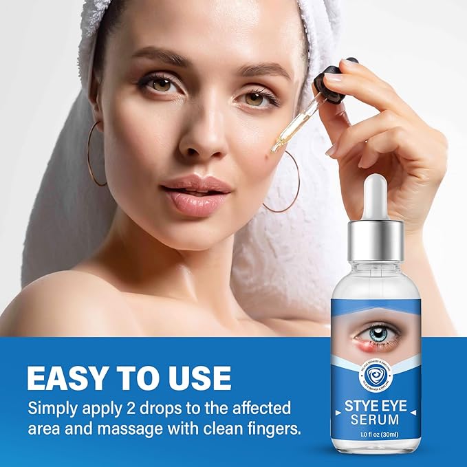 Stye Eye Treatment, Stye Eye Serum for Styes Chalazion and Blepharitis, Gently Cleanses Lashes and Eyes, Restore Healthier Eye Skin, 1 Fl.oz-BrightBean Baby