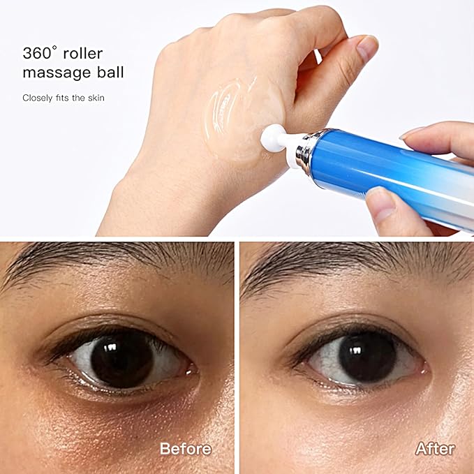 5% Caffeine Eye Serum with 360° Massage Rollerball Topper,Caffeine Eye Cream for Dark Circles,Wrinkles,Puffiness and Fine Lines,Under Eye Roller Cream Eye Bags Treatment for Women and Men-BrightBean Baby