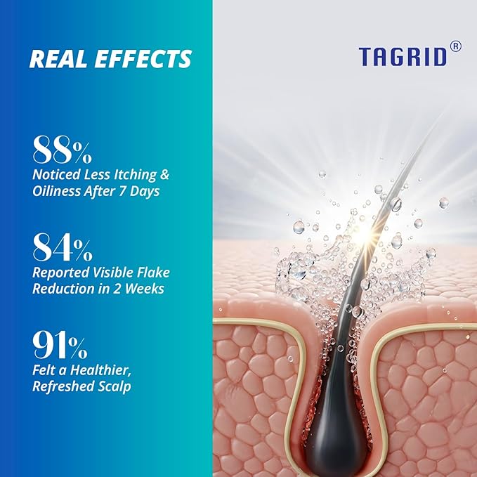 TAGRID Anti-Fungal Shampoo 300mL – Scalp Treatment for Psoriasis, Seborrheic Dermatitis, Folliculitis, Dandruff & Itchy Flaky Scalp – Soothing Plant-Based Formula for Men & Women-BrightBean Baby