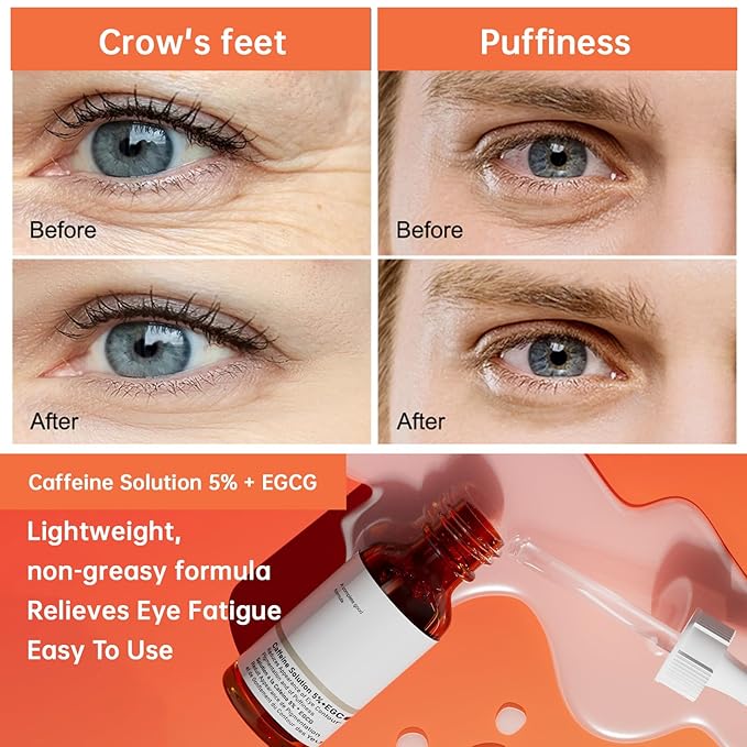 The Caffeine Solution 5% + EGCG,Reduces Appearance of Eye Contour Pigmentation and Puffiness,Under Eye Serum (30ml) Caffeine For Face Moisturizing Serum (2)-BrightBean Baby