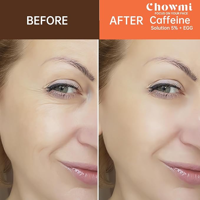 The Caffeine Solution 5% + EGCG,Reduces Appearance of Eye Contour Pigmentation and Puffiness,Under Eye Serum (30ml) Caffeine For Face Moisturizing Serum (1)-BrightBean Baby