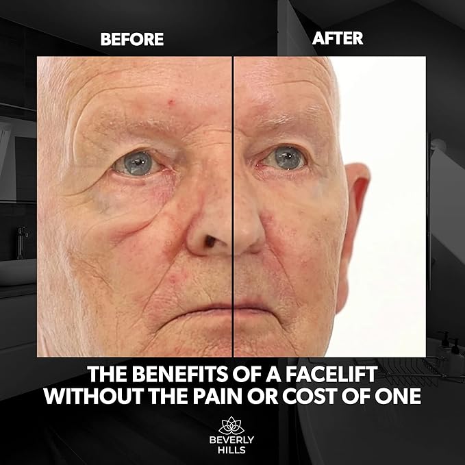 Beverly Hills Mens Instant Facelift and Eye Serum Treatment for Dark Circles, Puffy Eyes, and Wrinkles-BrightBean Baby