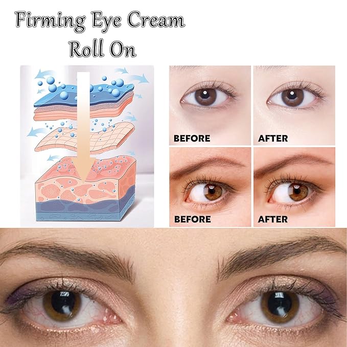 Caffeine Eye Cream Eye Serum, Under Eye Roller Cream for Dark Circles and Puffiness, 0.51 Fl Oz-BrightBean Baby