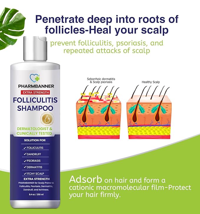 Anti-Fungal Shampoo for Folliculitis, Seborrheic Dermatitis, Scalp Psoriasis - Relieves Itchy & Dry Scalp-BrightBean Baby