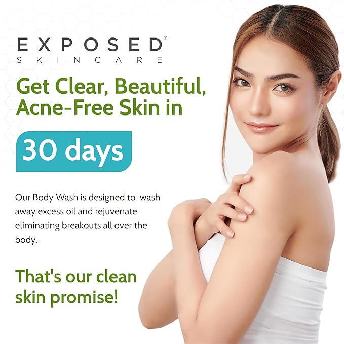Exposed Skin Care Body Wash - Back and Body Acne Wash with Salicylic Acid and Tea Tree Oil – Exfoliating Bacne Treatment for Clearer, Healthier Skin – Body Cleanser for All Skin Types (12 fl oz)-BrightBean Baby