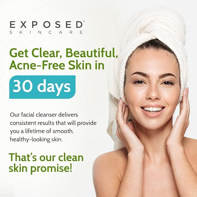 Exposed Skin Care Acne Facial Cleanser - Gentle Face Wash with Salicylic Acid for Acne Prone Skin - Pore Clarifying Acne Treatment for All Ages, Skin Types-BrightBean Baby