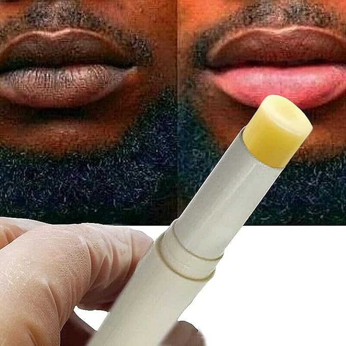 2pcs Lip Lightening for Dark Lips Lip Brightener for Smokers Dark Lip Treatment Lightening Cream for Pink Lips Lip Lightener for Smoker Lips Lip Lightening balm for Men and Women (Yellow)-BrightBean Baby