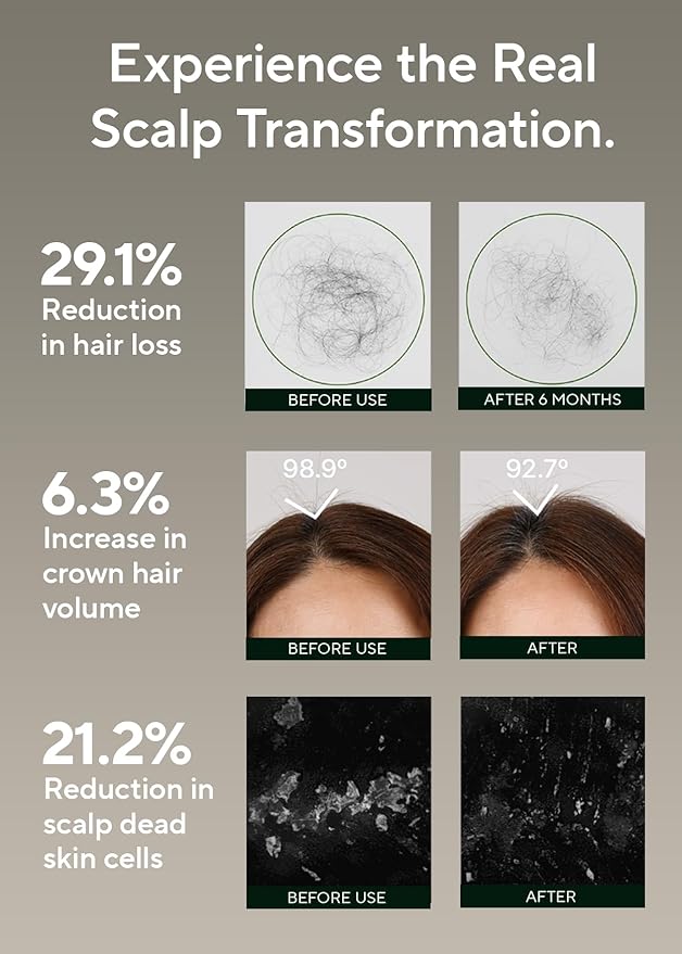 AROMATICA Rosemary Salt Scrub Shampoo - Hair Loss Korean Scalp Detox Shampoo with Rosemary Scalp Oil | Scalp Exfoliator with Salt Scrub for Oily Scalp | Sulfate Free, Silicone Free (10.5 oz / 300g)-BrightBean Baby
