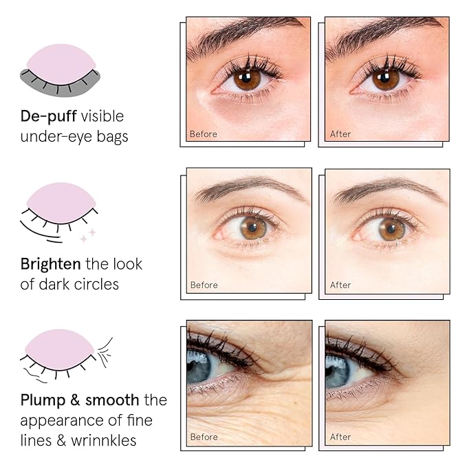 grace & stella Under Eye Patches (12 pairs) Eye Masks for Dark Circles and Puffiness - Birthday Gifts for Women, Bachelorette Party Favors, Bridesmaid Proposal Gifts, Self Care, Spa, Relaxation, Vegan-BrightBean Baby