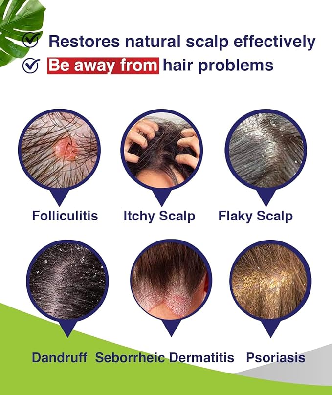 Anti-Fungal Shampoo for Itchy, Dry Scalp – Supports Scalp Health, Helps with Folliculitis, Seborrheic Dermatitis & Scalp Flaking-2 Pack-BrightBean Baby