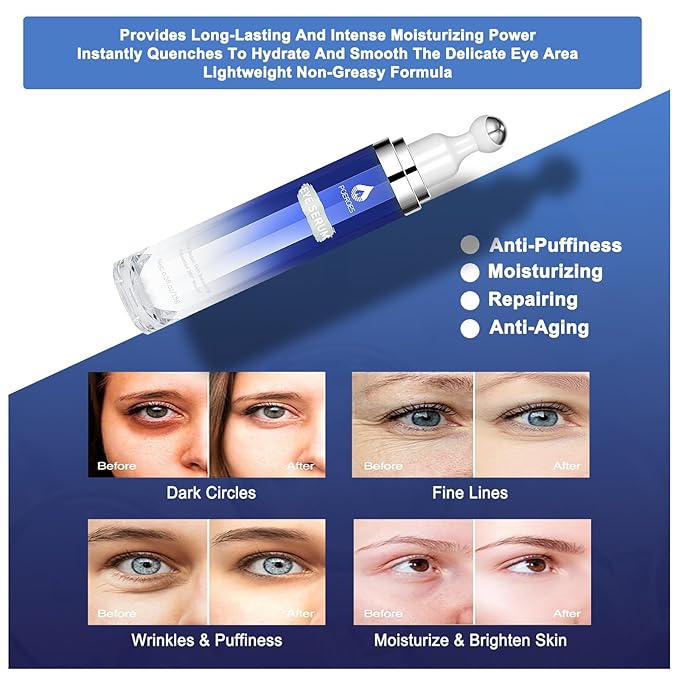 eye serum for dark circles and puffiness - 8% Caffeine, 8% Retinol - Dark Circle Remover, Puffy Eyes & Bags - Under Eye Cream, 1.5 fl. oz-BrightBean Baby