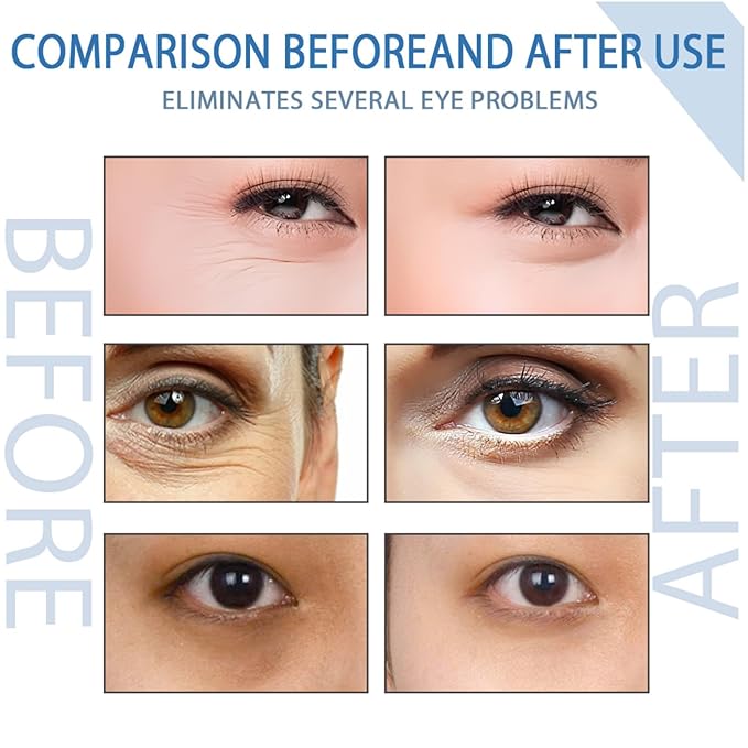 Peptide Depuffing Eye Serum, Himeye Peptide Eye Serum, Men's Caffeine Eye Serum, Men's Collagen Anti-Aging Eye Cream for Wrinkles, 0.5 Ounce (Pack of 2)-BrightBean Baby
