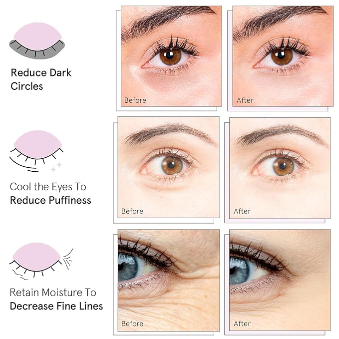 grace & stella Under Eye Mask Variety Pack - 18 Pairs of Under Eye Patches for Dark Circles - With 6 Colors (3 Pairs/Color) - Gel Masks Puffy Eyes for Women - Vegan Cruelty Free Bridesmaid Gifts-BrightBean Baby