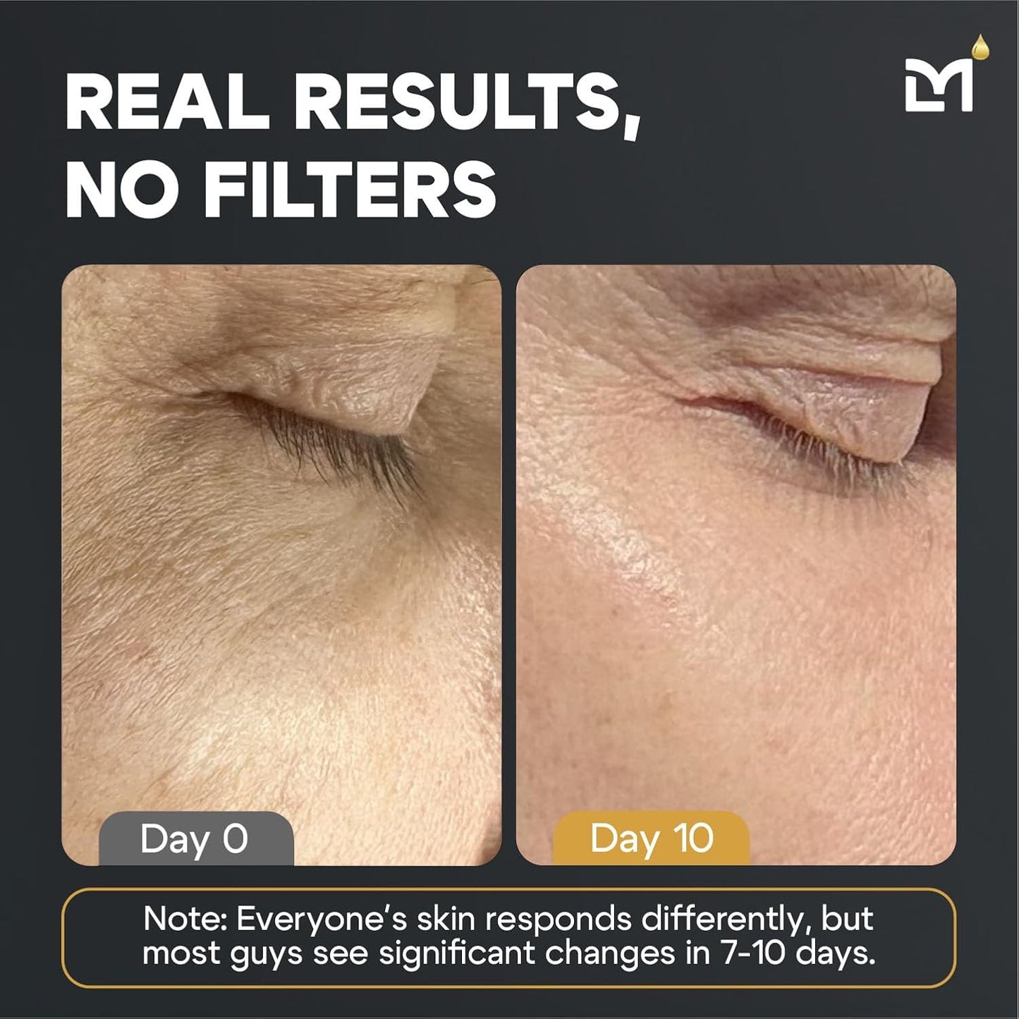 Titan Oscar Anti-Aging Mens Skin Care Kit – Wash, Face Serum, Eye Cream, Mens Face Moisturizer – Men, Skin Care Set – Dark Circles, Wrinkles, Fine Lines – Vitamin C, Peptides, Niacinamide, HA-BrightBean Baby