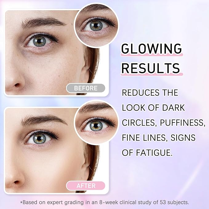 5% Caffeine Eye Cream Eye Serum Kit for Dark Circles Under Eye Treatment For Puffiness Bags And Wrinkles Eye Cream Anti Aging Eye Serum & Eye Roller 2 Fl Oz-BrightBean Baby