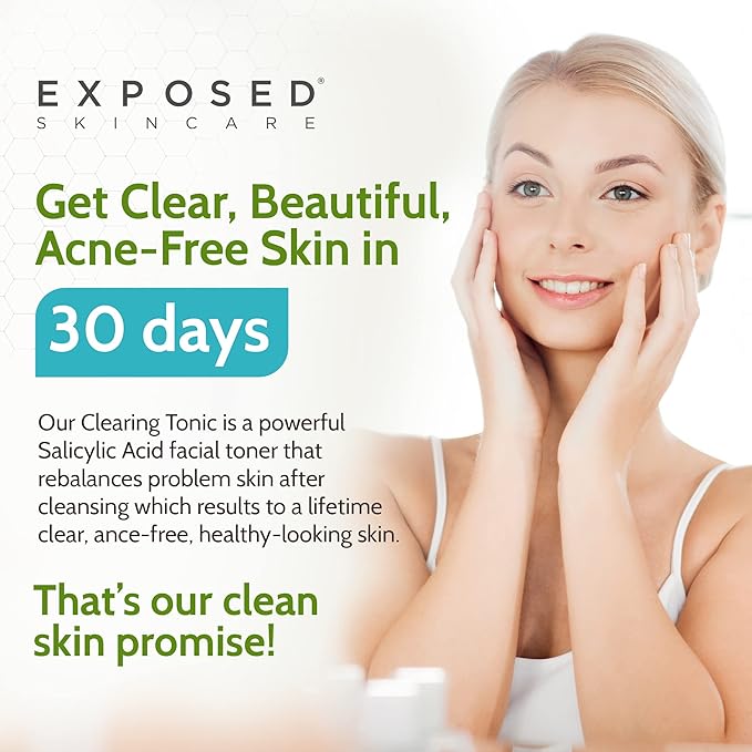 Exposed Skin Care Clearing Tonic Facial Toner with 1% Salicylic Acid and Witch Hazel for Acne Treatment – Pore Minimizing Toner to Prevent Breakouts, Reduce Redness and Balance Skin – Step 2 (4 fl oz)-BrightBean Baby