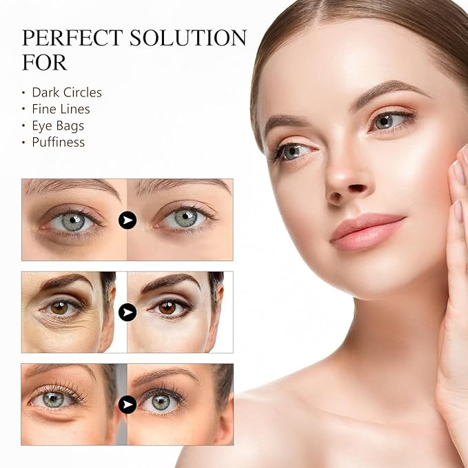 Caffeine Eye Serum Anti Aging, Eye Serum for Dark Circles and Puffiness, Retinol Eye Cream with 360°Massage Ball, Reduce Eye Wrinkles and Fine Lines-BrightBean Baby