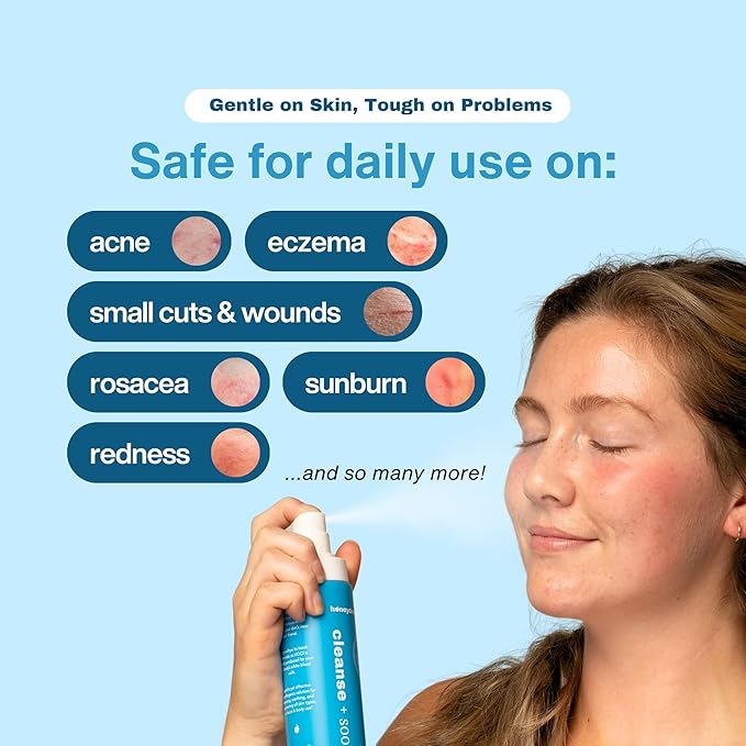 Hypochlorous Acid Spray – HOCl Face & Skin Mist for Acne, Eczema & Irritation – Multi-Purpose Skin Repair – Eyelid Cleanser, Post-Workout, Post-Procedure, Scalp & Sensitive Skin – 6.8 oz