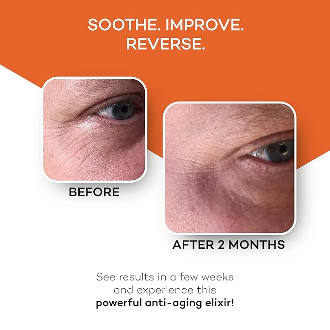 Zocufill Elixir Eye Gel and Face Serum - Eye Bags Treatment for Women and Men - Reduce the Appearance of Dark Circles, Puffy Eyes, Fine Lines and Wrinkles-BrightBean Baby