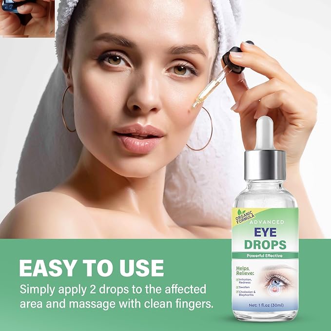 Stye Eye Treatment, Stye Eye Drops Serum for Styes Chalazion and Blepharitis, Chalazion Remover Fast Relief, Restore Healthier Eye Skin, 30ml-BrightBean Baby