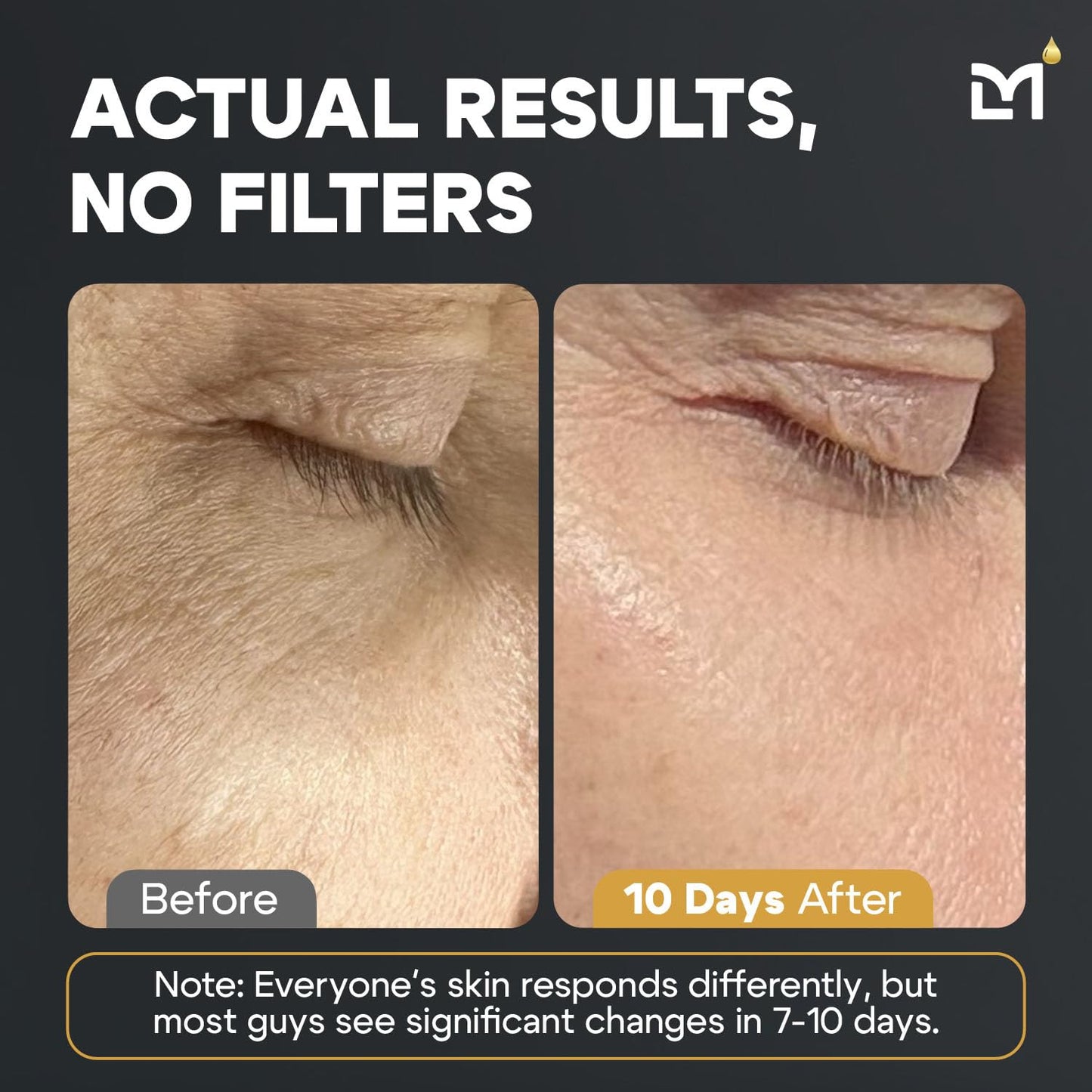 Titan Golden Anti-Aging Mens Skin Care Kit – Wash, Face Serum, Mens Face Moisturizer – Men, Skin Care Set – Dark Spots, Wrinkles, Fine Lines – Vitamin C, Peptides, Niacinamide, HA – Unscented-BrightBean Baby