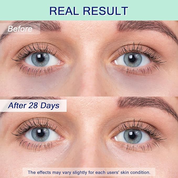 Eye Serum for Dark Circles, 5% Caffeine Under Eye Cream for Wrinkles, Morning Puffiness and Fine Lines, Deeply Repairs the Muscles Around the Eyes with 360°Massage Ball, 0.5 Fl Oz-BrightBean Baby